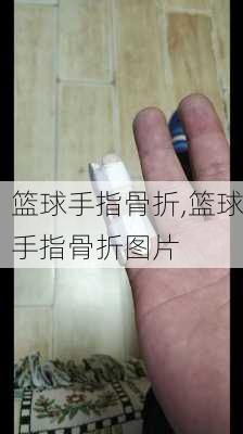 篮球手指骨折,篮球手指骨折图片