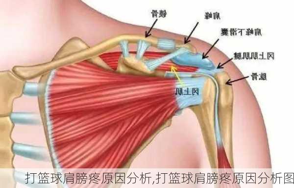 打篮球肩膀疼原因分析,打篮球肩膀疼原因分析图